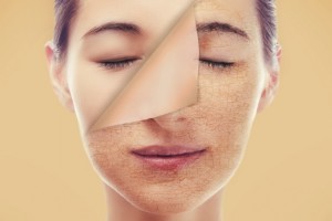Najpogostejši vzroki za suho kožo